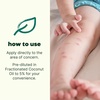 image:imagePlant Therapy Kids Itch Away PreDiluted Essential Oil RollOn 10 mLItch Away